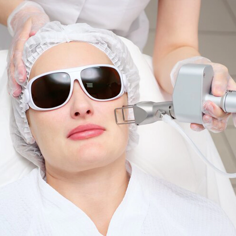 CO2 Fractional Laser